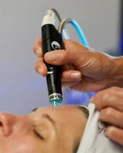 Hydrafacial 